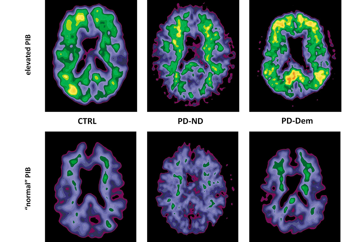 健康・医学 Underground clinical Vignettes Amazon.com: Underground Clinical Vignettes: Pathophysiology