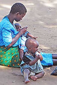 Bacteria living in the intestine are an underlying cause of a form of severe acute childhood malnutrition