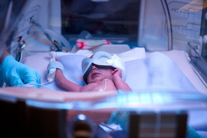 Premature-birth-brain