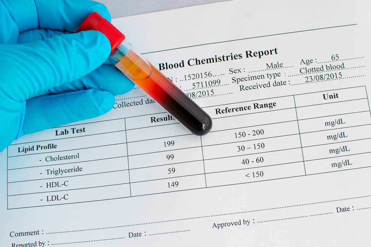 High and low levels of 'good cholesterol' may cause premature ...