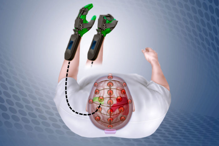 Mind-controlled device helps stroke patients retrain brains to move ...