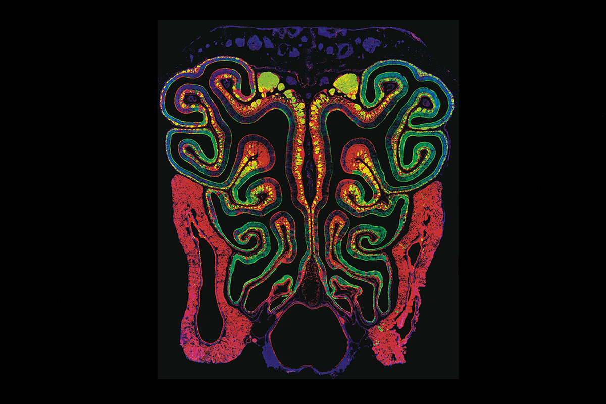 Developmental Biologists Win Bioart Competition Washu Medicine