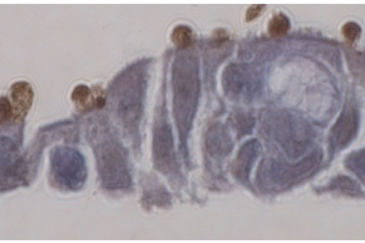 Treatment for common cause of diarrhea more promising – WashU Medicine