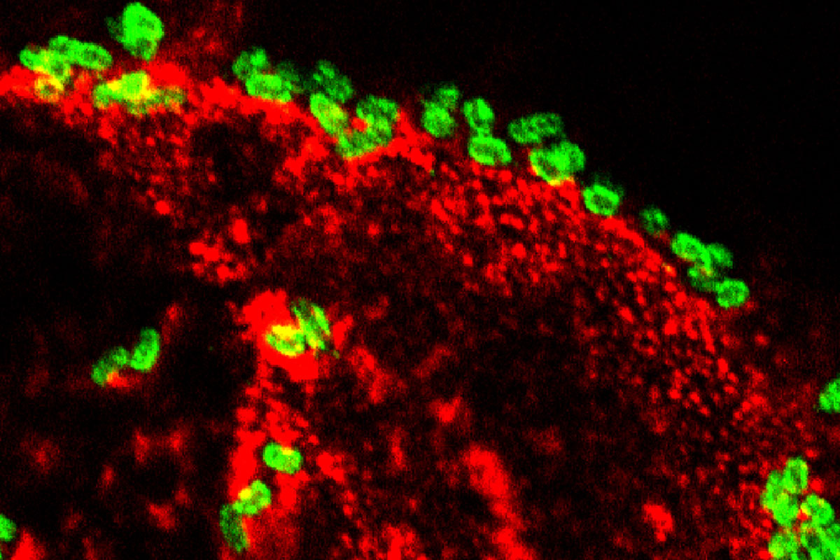 Toxin provides clues to long-term effects of diarrhea caused by E. coli   WashU Medicine