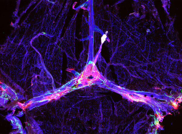 The blood vessels and drainage network in a mouse’s brain are outlined in blue and green, and dotted with clumps of the Alzheimer’s protein amyloid beta (red).