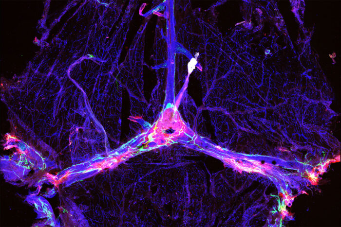 The blood vessels and drainage network in a mouse’s brain are outlined in blue and green, and dotted with clumps of the Alzheimer’s protein amyloid beta (red).