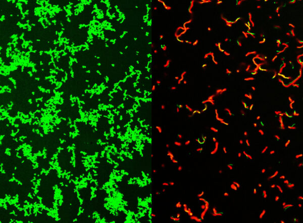 Microscope image of living untreated Streptococcus pyogenes culture stained green and treated dead bacteria stained red.