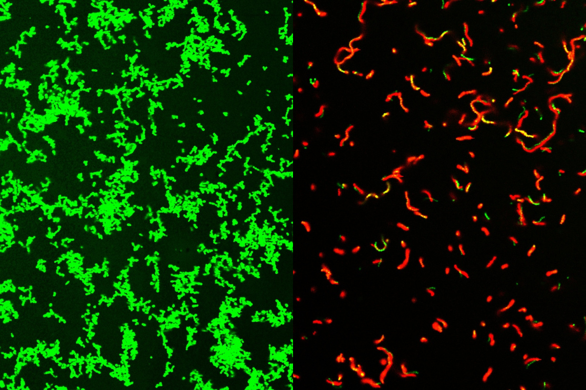 Microscope image of living untreated Streptococcus pyogenes culture stained green and treated dead bacteria stained red.