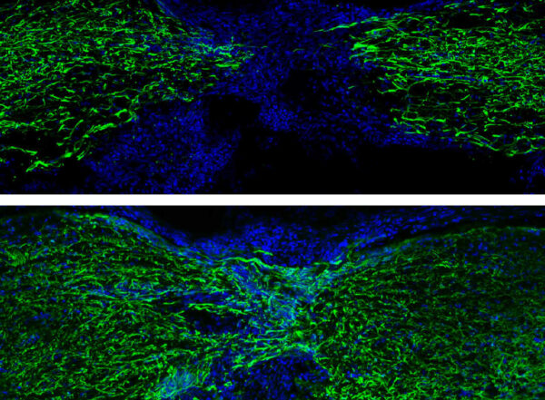 The image represents spinal cord regeneration in zebrafish at 1 week (top) and 4 weeks (bottom) post-injury (glial Gfap staining in green and nuclei in blue).