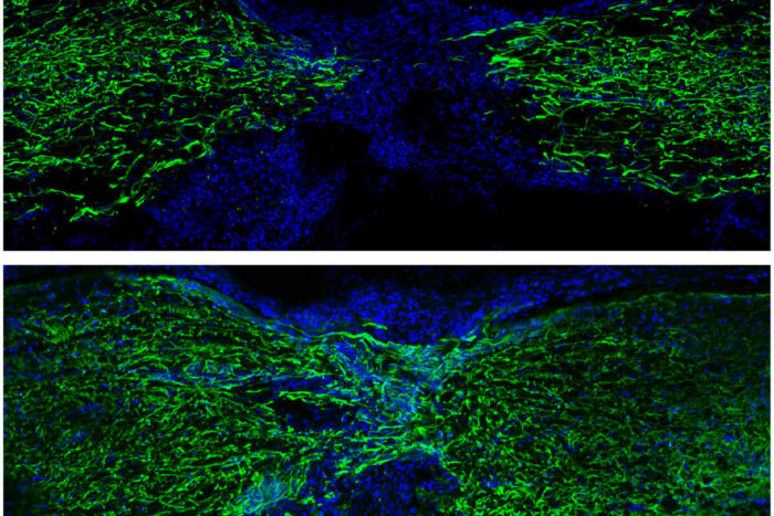 The image represents spinal cord regeneration in zebrafish at 1 week (top) and 4 weeks (bottom) post-injury (glial Gfap staining in green and nuclei in blue).