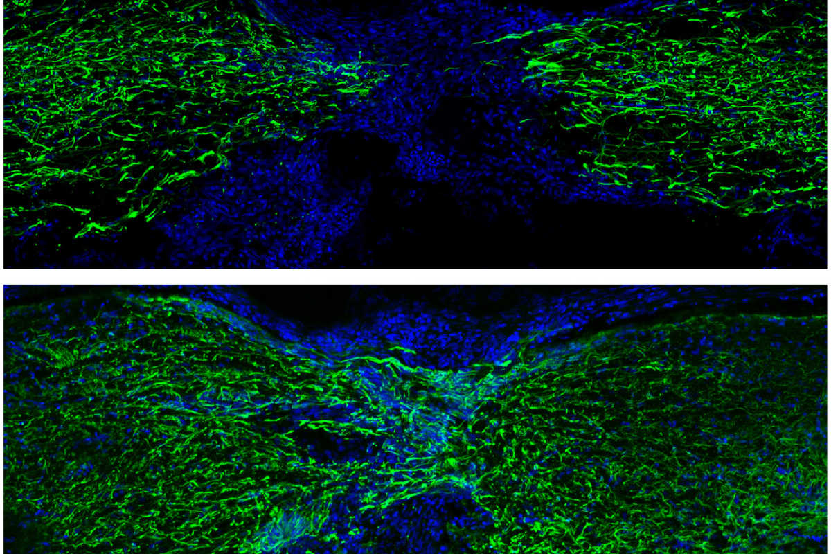 The image represents spinal cord regeneration in zebrafish at 1 week (top) and 4 weeks (bottom) post-injury (glial Gfap staining in green and nuclei in blue).