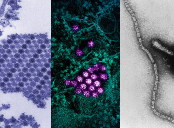 Micrographs of chikungunya, dengue and parainfluenza virus particles