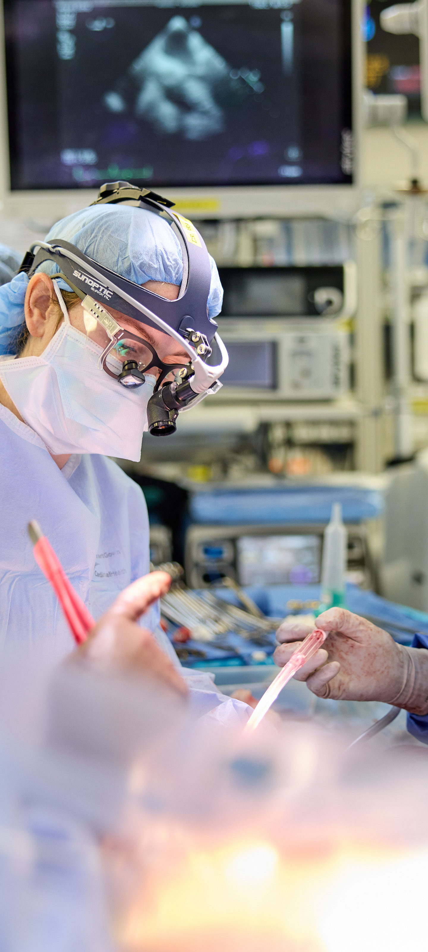 Four doctors in an operating room during an operation.