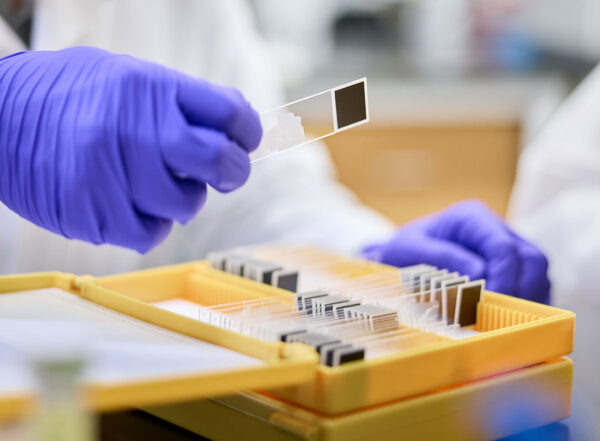 A researcher wearing purple gloves examines samples on glass slides