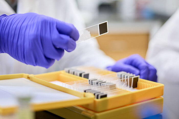 A researcher wearing purple gloves examines samples on glass slides