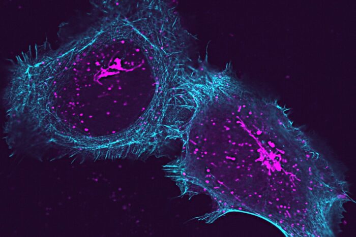 A human cell prepares to release infection-fighting molecules called cytokines (labeled magenta).