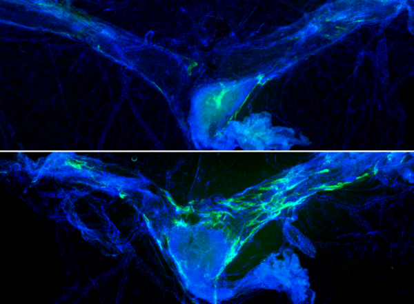 Fluorescent microscopy image of mouse meninges labeled in blue and lymphatics labeled in green, comparing mice with and without rejuvenated lymphatics