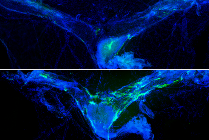 Fluorescent microscopy image of mouse meninges labeled in blue and lymphatics labeled in green, comparing mice with and without rejuvenated lymphatics