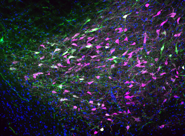 Cells from a rat brain are stained purple, green and white.