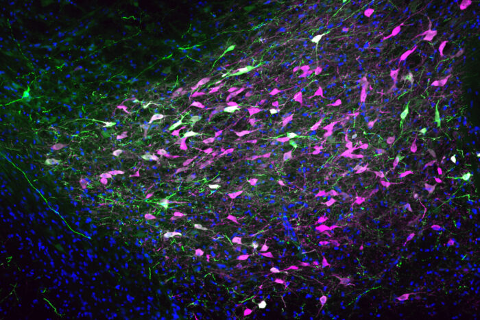 Cells from a rat brain are stained purple, green and white.