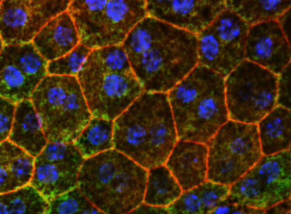 Color-stained close-up image of retinal cells from mice