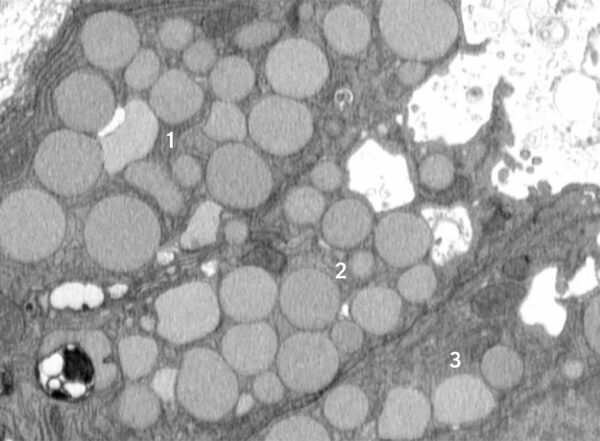 View from top of three mouse stomach cells shown in gray and white