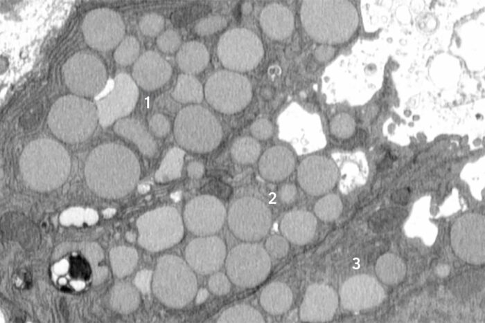 マウス研究で傷の治癒を促す細胞排出メカニズムを発見(Cells ‘Vomit’ Waste to Promote Healing, Mouse Study Reveals)