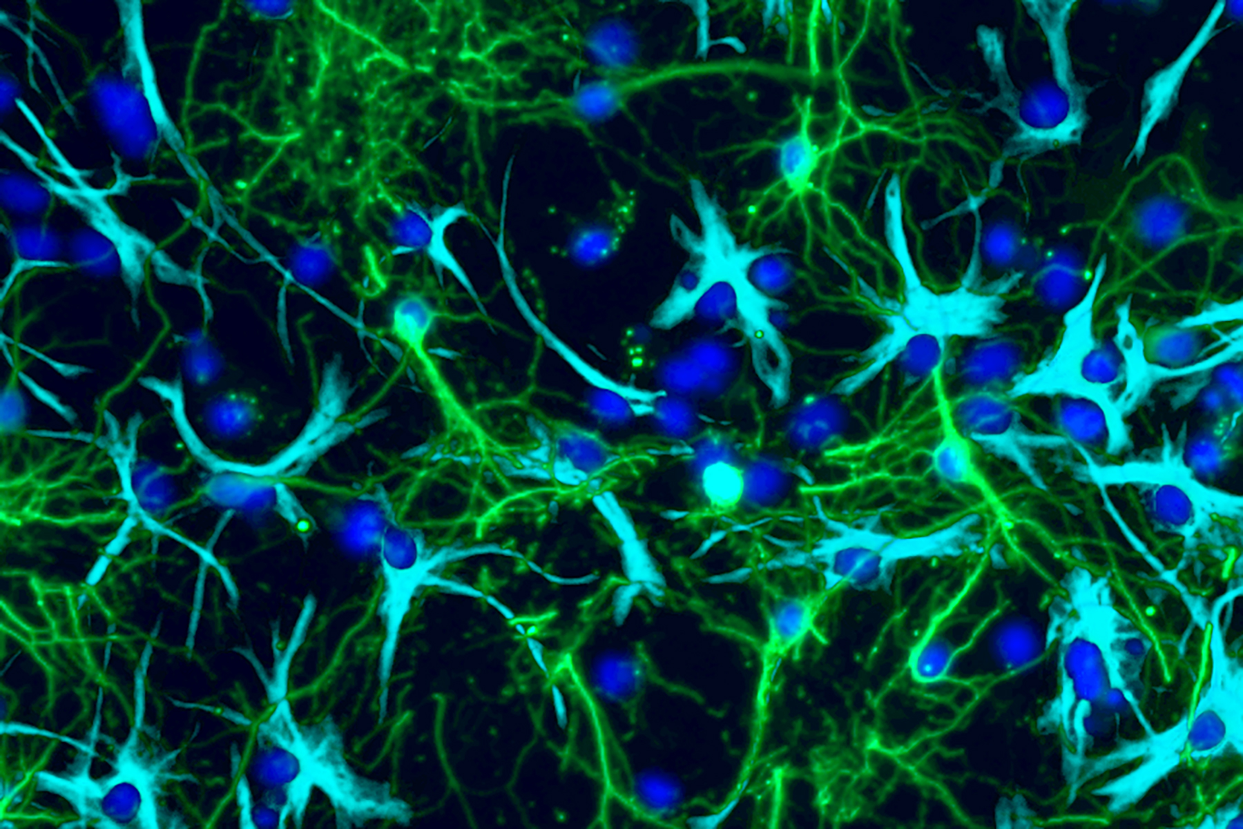 Neuron Growing Study sheds light on how pediatric brain tumors grow – WashU Medicine