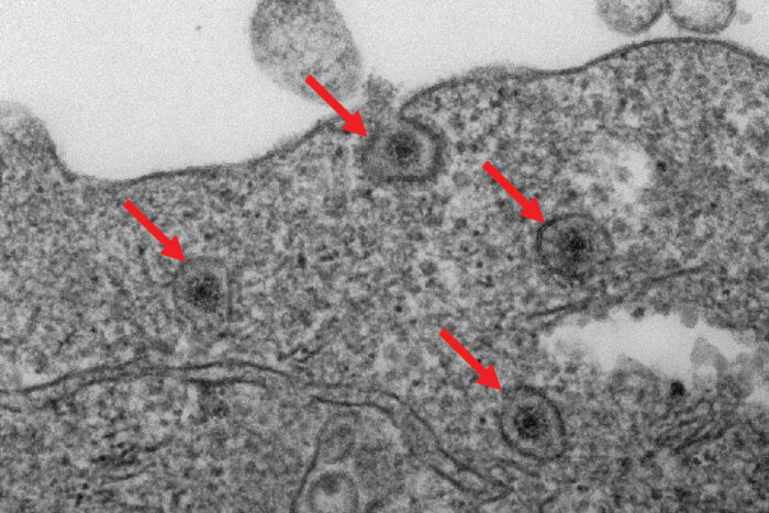 An image of part of a cell showing four places where rotavirus has broken through the cell wall and become fully enclosed by an endosome inside the cell.