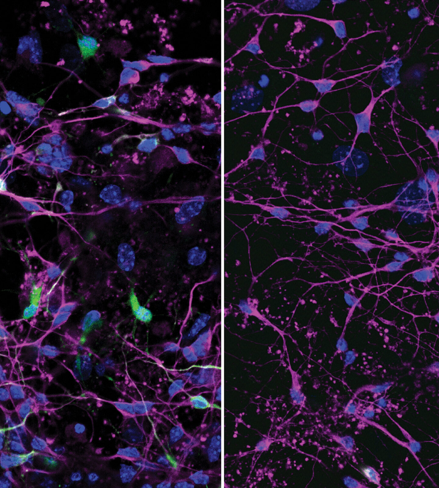 Mouse neurons with and without viral infection.