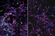 Mouse neurons with and without viral infection.