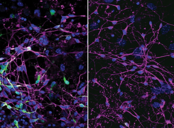 Mouse neurons with and without viral infection.
