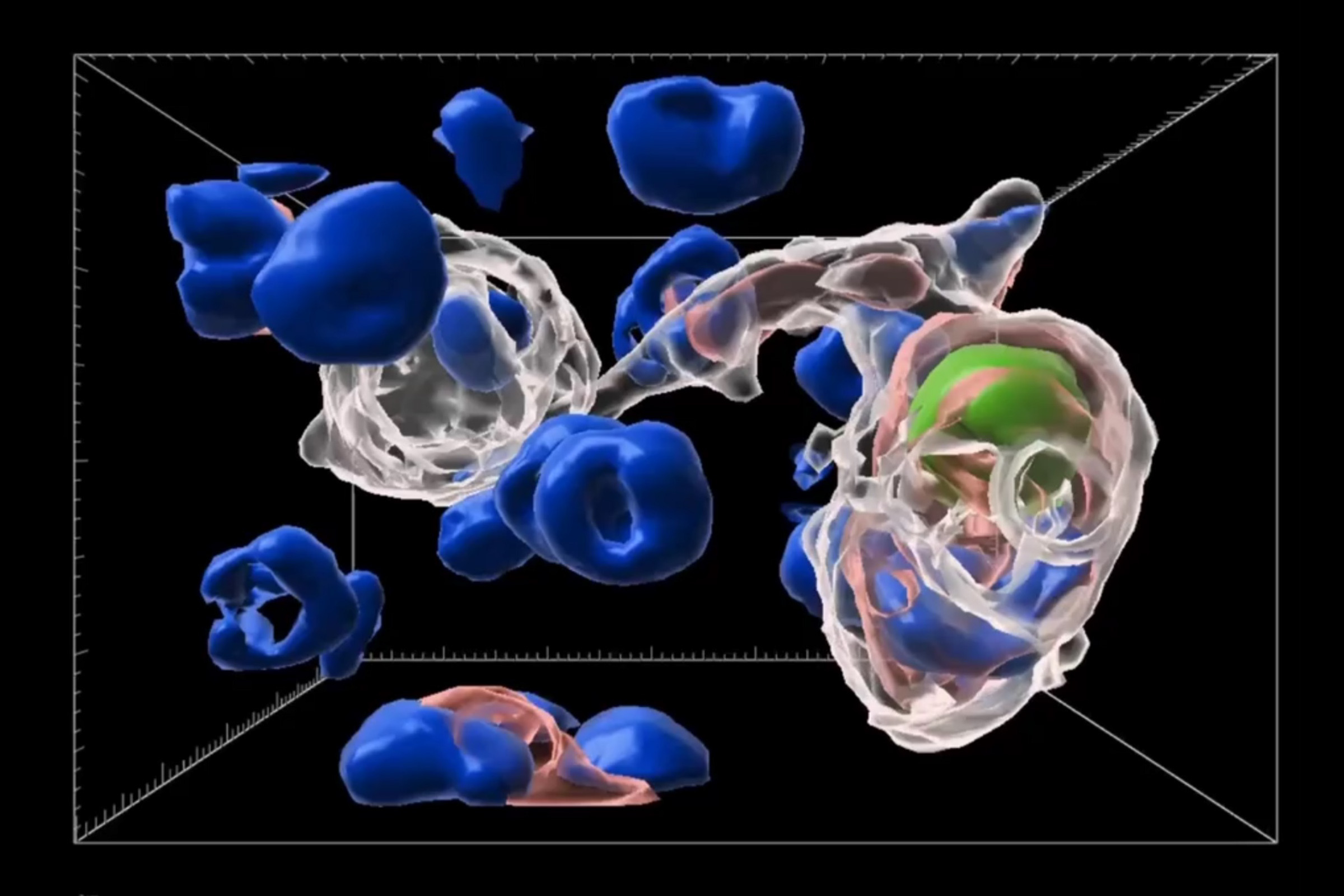 Body's garbage-collecting cells protect insulin production in pancreas   WashU Medicine