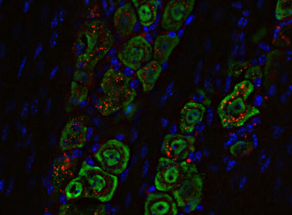 Microscopy image of particle concentrations in cross section of a mouse nerve.