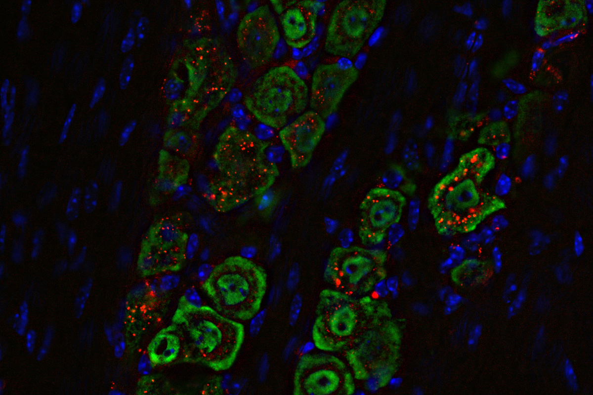 Microscopy image of particle concentrations in cross section of a mouse nerve.