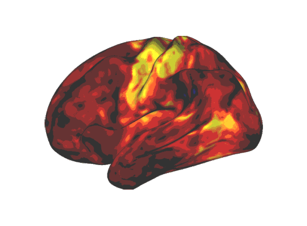 Animated image of rotating brain with areas activated by stimulant medication shown in yellow