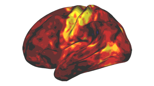 Animated image of rotating brain with areas activated by stimulant medication shown in yellow