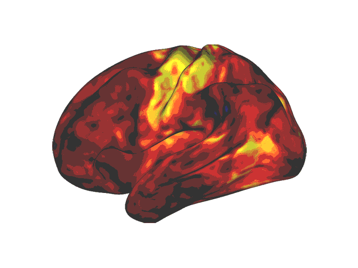 Animated image of rotating brain with areas activated by stimulant medication shown in yellow