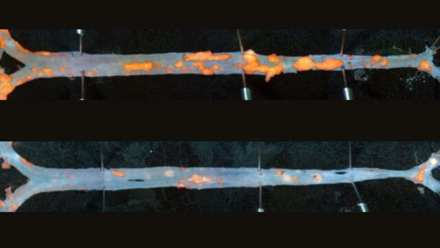 Image shows two mouse arteries with arterial plaque in orange.