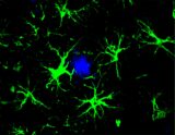 astrocytes in green surrounding harmful brain plaques in blue