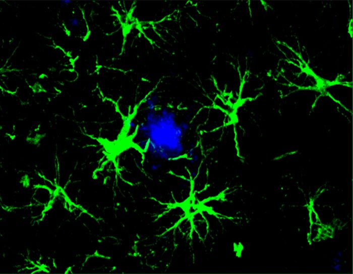 astrocytes in green surrounding harmful brain plaques in blue