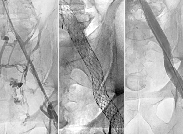 Radiographic images of veins
