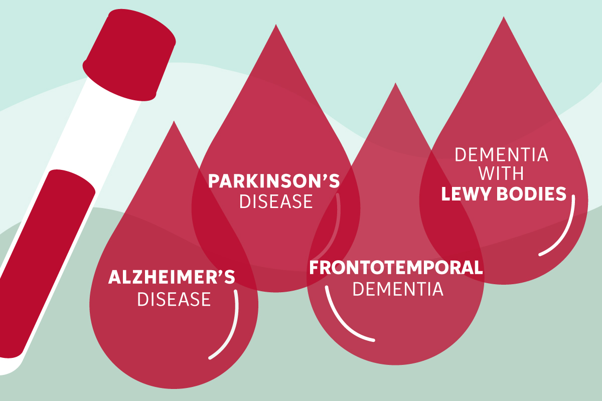 Joel Perlmutter, MD | Neurology