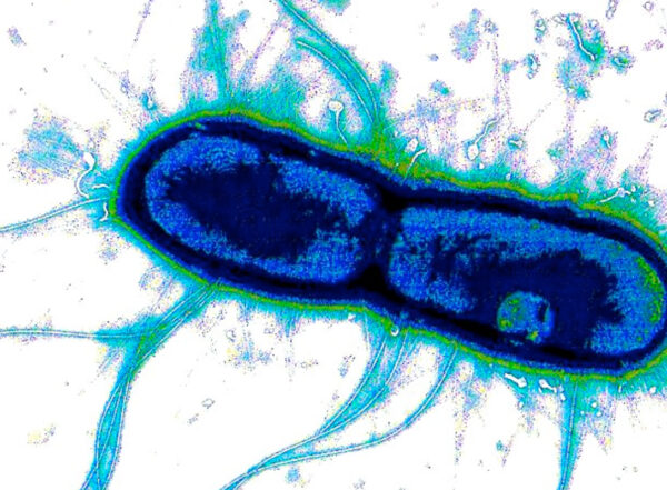 An electron microscopy image of enterotoxigenic E. coli