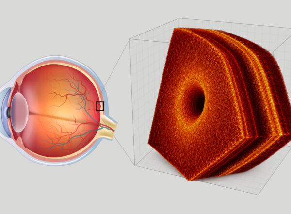 an eyeball with a zoomed out image of a piece of the retina shown on an OCT scan