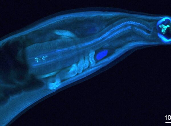 An image of a hookworm