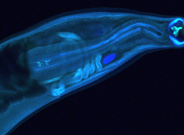 An image of a hookworm