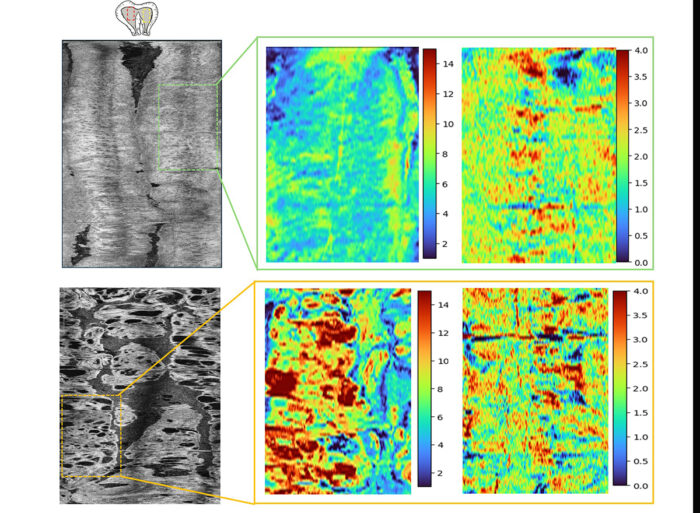Two black and white and four colorful medical scans