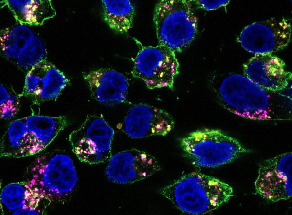 Microscope image of drugs binding to pancreatic cancer cells.