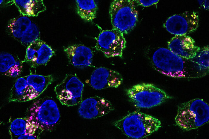 Microscope image of drugs binding to pancreatic cancer cells.